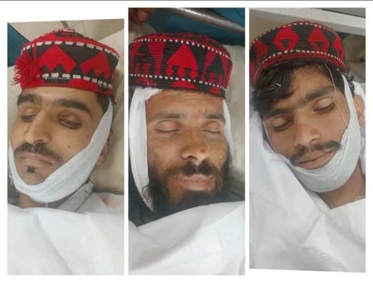 پاکستاني پولیسو؛د قامي لویې جرګې میدان کې ۱۸ تنو ته مرګ ژوبله اړولې