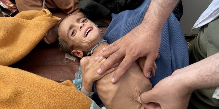 اوچا: افغانستان راتلونکو څلورو میاشتو کې د خوارځواکۍ له سختې څپې سره مخ دی